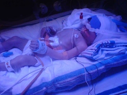 child in incubator