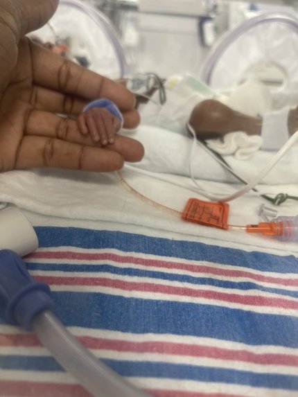 photo of a mom with a baby's hand in the NICU